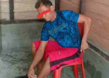 Bebaiaji Hia, Warga Pulau Banyak Barat Aceh Singkil Hampir Tewas di Terkam Buaya