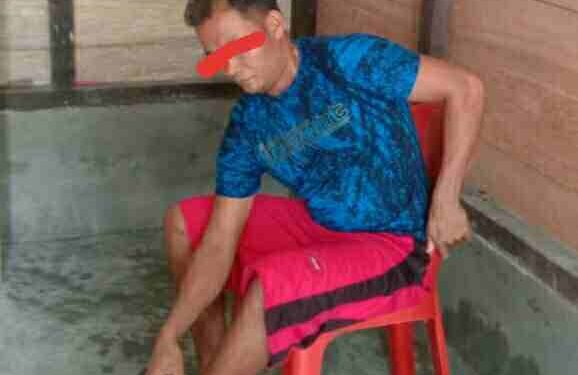 Bebaiaji Hia, Warga Pulau Banyak Barat Aceh Singkil Hampir Tewas di Terkam Buaya