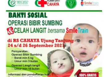 RS Cahaya Bekerjasama Dengan Smile Train Dan RS Ibnu Sina Akan Gelar Operasi Sumbing Gratis