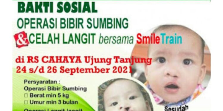RS Cahaya Bekerjasama Dengan Smile Train Dan RS Ibnu Sina Akan Gelar Operasi Sumbing Gratis