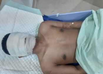 Wajah Disiram Air Keras Oleh OTK, Pimred Media Online Di Medan Dilarikan Ke RS Adam Malik