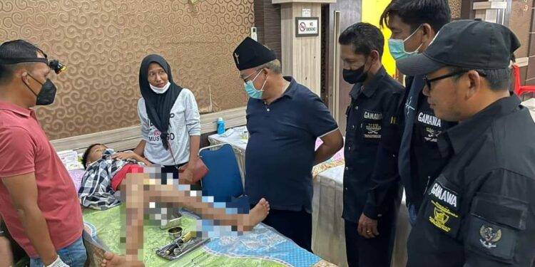 GAMAWA laksanakan Kegiatan Sunatan Massal Target 150