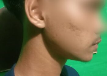 Diduga Terbakar Api Cemburu, Pulang Ngantar Cewek, Hafis Dihajar 2 OTK