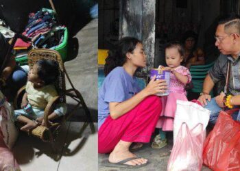 Wong Chun Sen Haru dan Bahagia Bayi Stunting, Ternyata Keduanya Sudah Banyak Perubahan