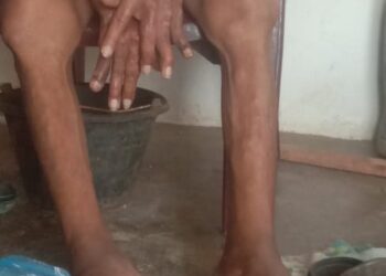 PT PEU Teluk Dalam, Asahan “Paksa” Karyawan Sakit Bekerja