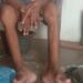 PT PEU Teluk Dalam, Asahan “Paksa” Karyawan Sakit Bekerja
