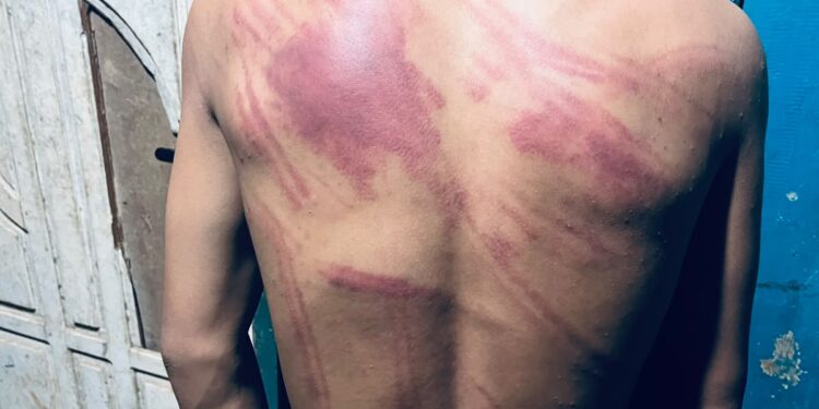 Prof. Sutan Nasomal Minta Kapolda Sultra Perintahkan Kapolres Kolaka Usut Transparan Dugaan Penganiayaan di Lingkungan PT MPP